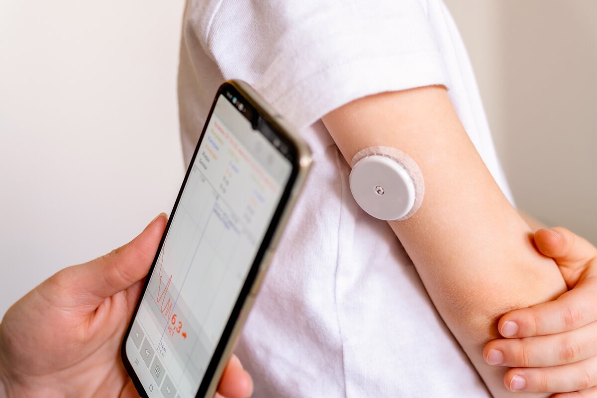 CGM system image 2