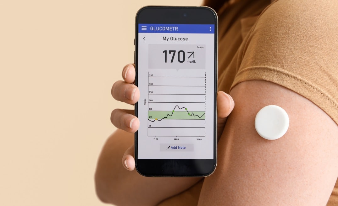 CGM system image 3