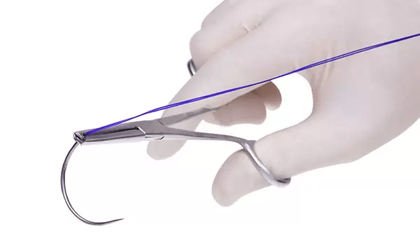 Surgical sutures image 1