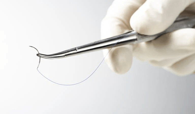 Surgical sutures image 2
