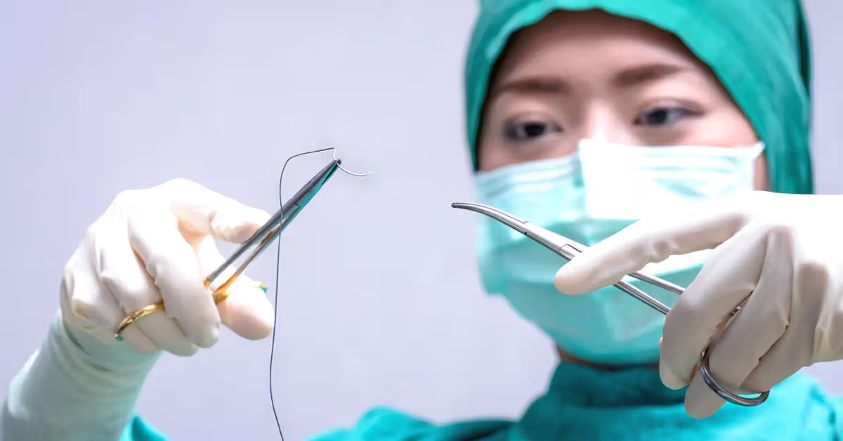 Surgical sutures image 4