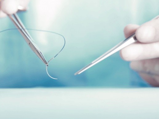 Surgical sutures image 3